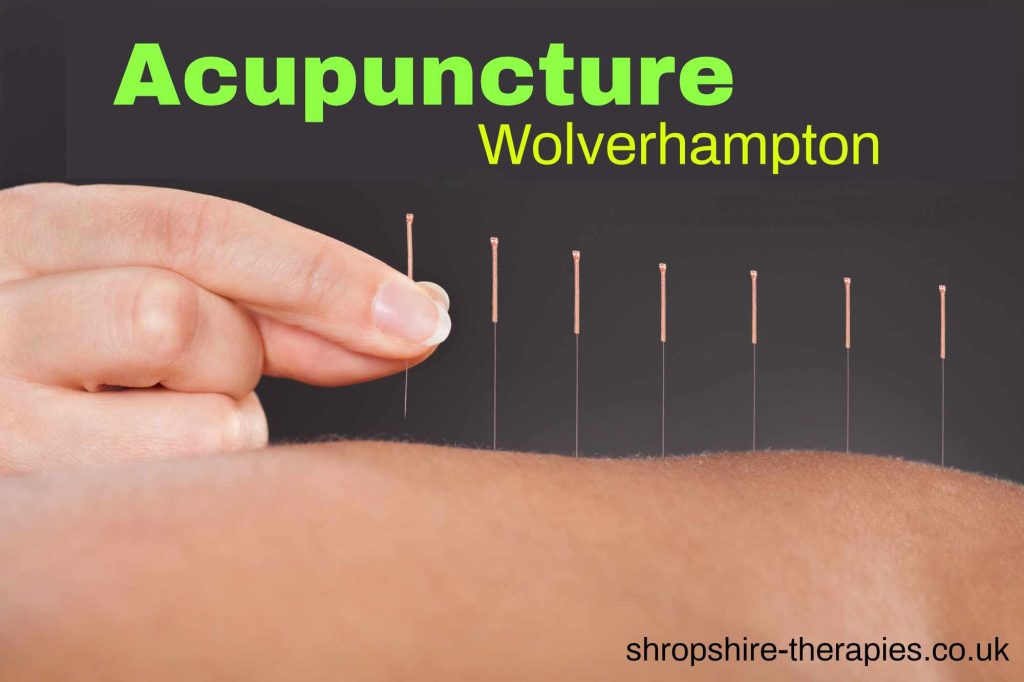 acupuncturist wolverhampton area